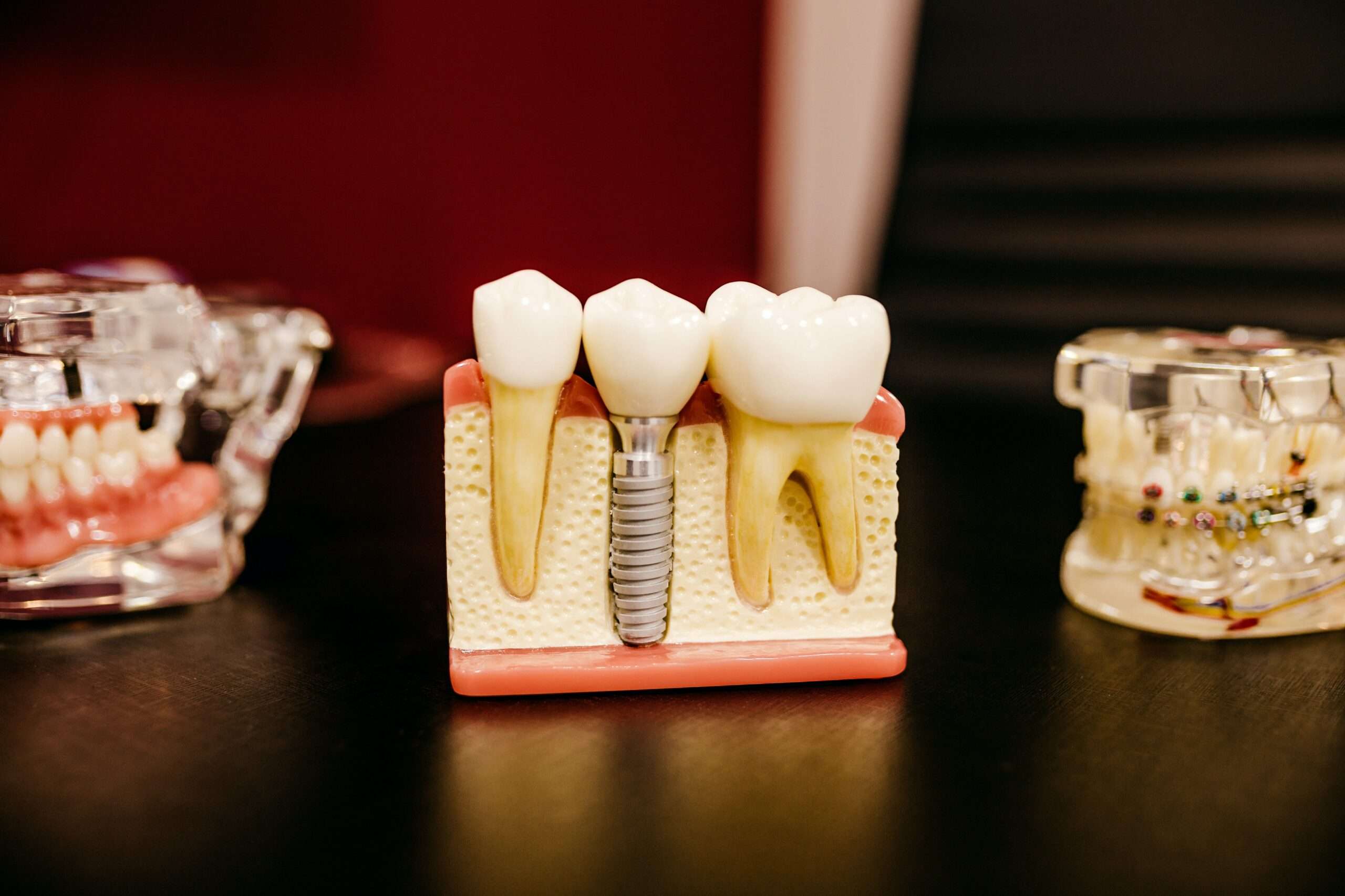 About Us - Model of a teeth on a table